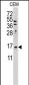LSM1 Antibody (C-term)